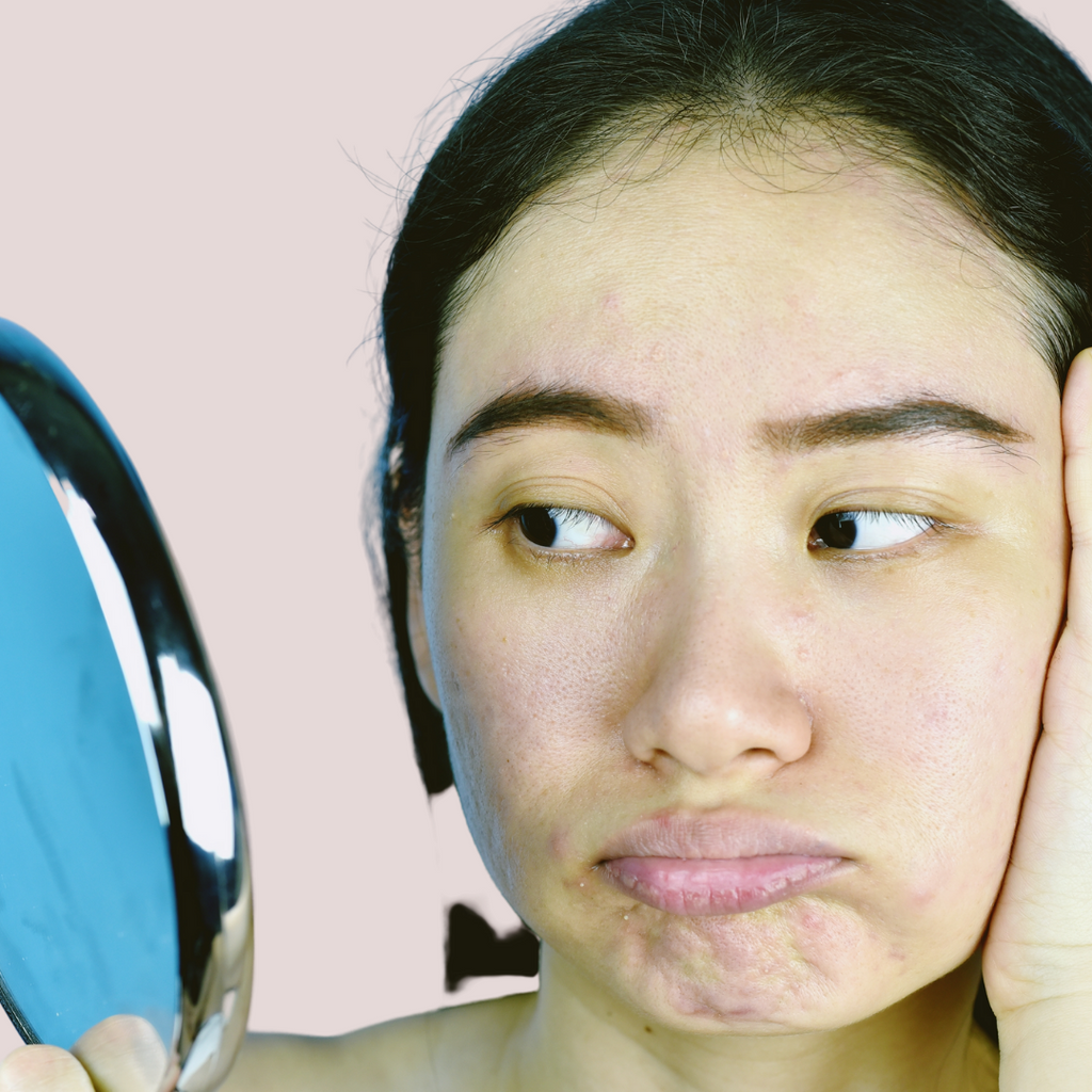 3 REASONS WHY YOUR SKIN IS DULL